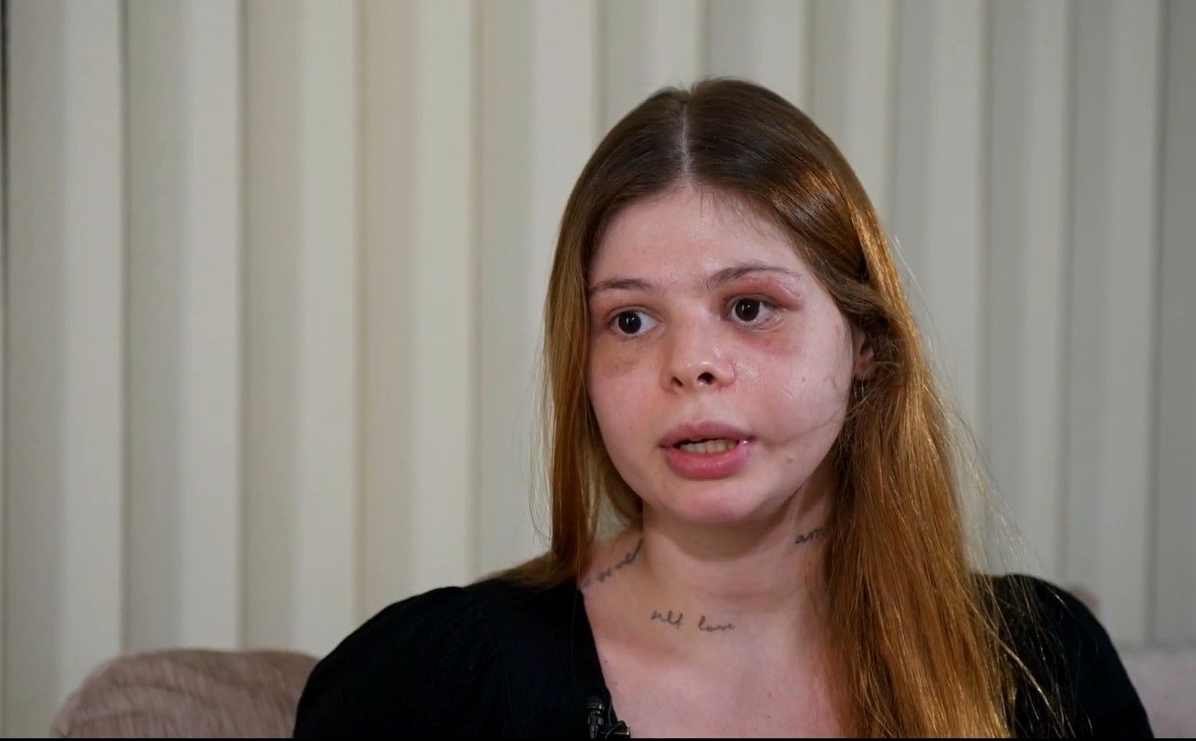 Médica relata marcas de agressão e luta contra feminicídio