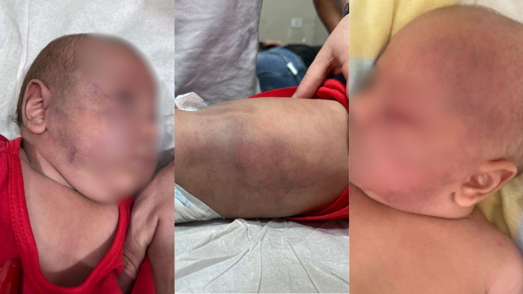 Pai condenado a 22 anos por espancar bebê de 3 meses