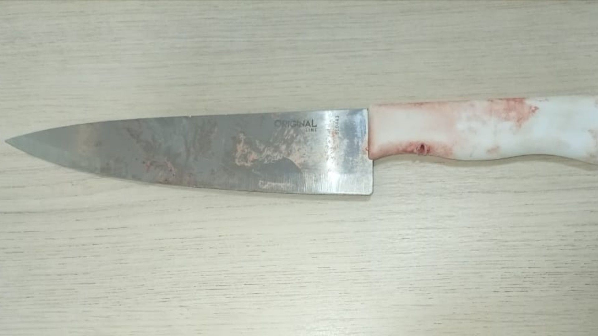 Mulher agredida pelo ex-marido em Mirassol SP