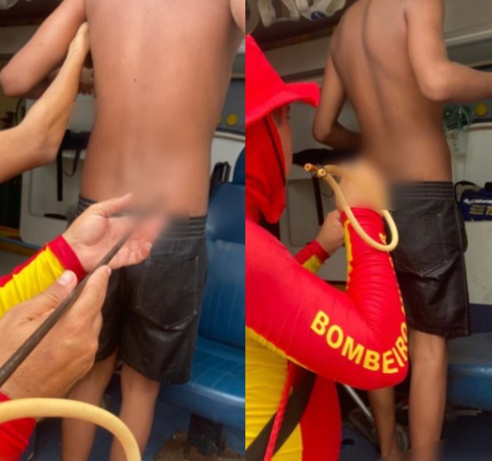 Adolescente é atingido por arpão durante pesca na Praia do Francês