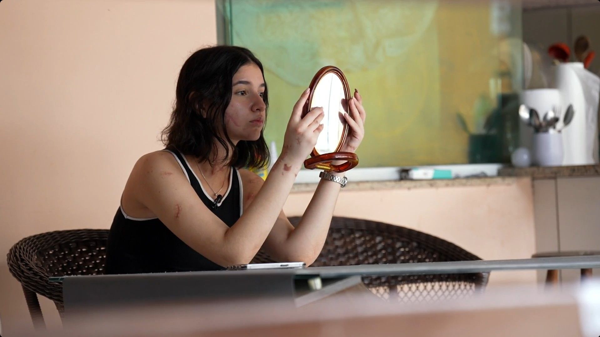 Ataques a Mulheres Revelam Violência e Identidade Subtraída