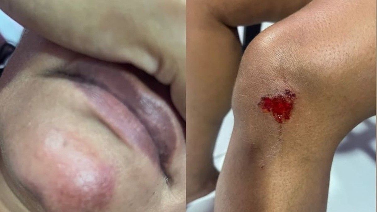 Homem arremessa mulher de carro em movimento e é preso